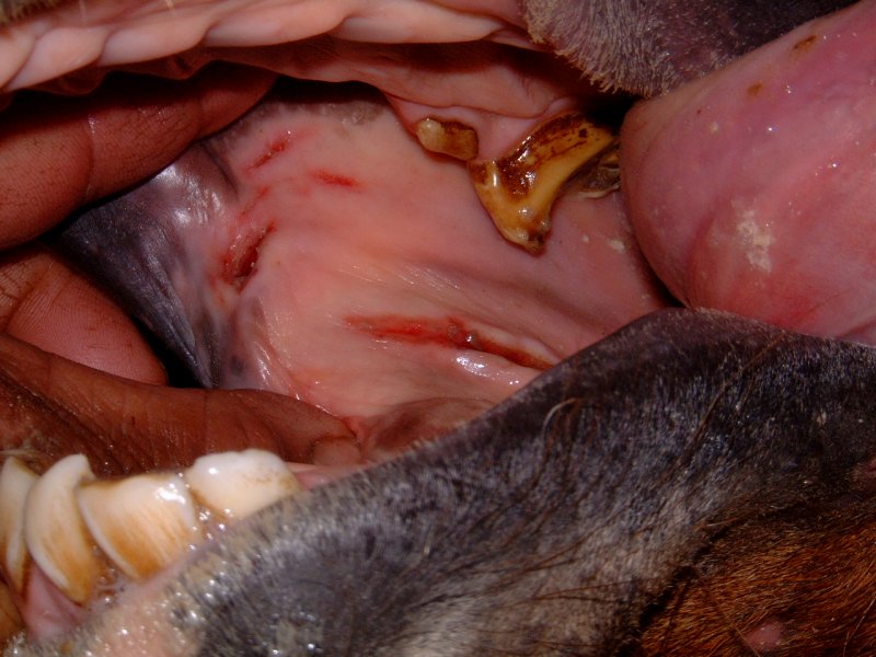 Cheek lacerations caused by large hooks on the upper second premolars